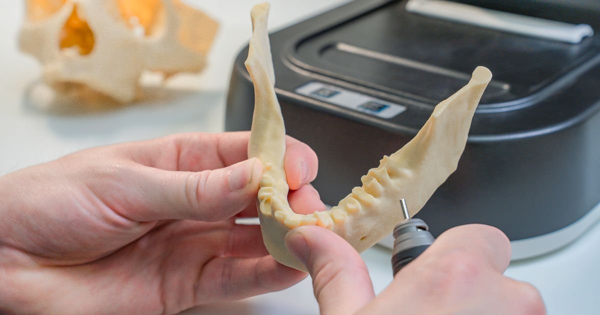 Gloved hands holding a 3D-printed dental model in a digital dental lab, with milling equipment visible in the background.
