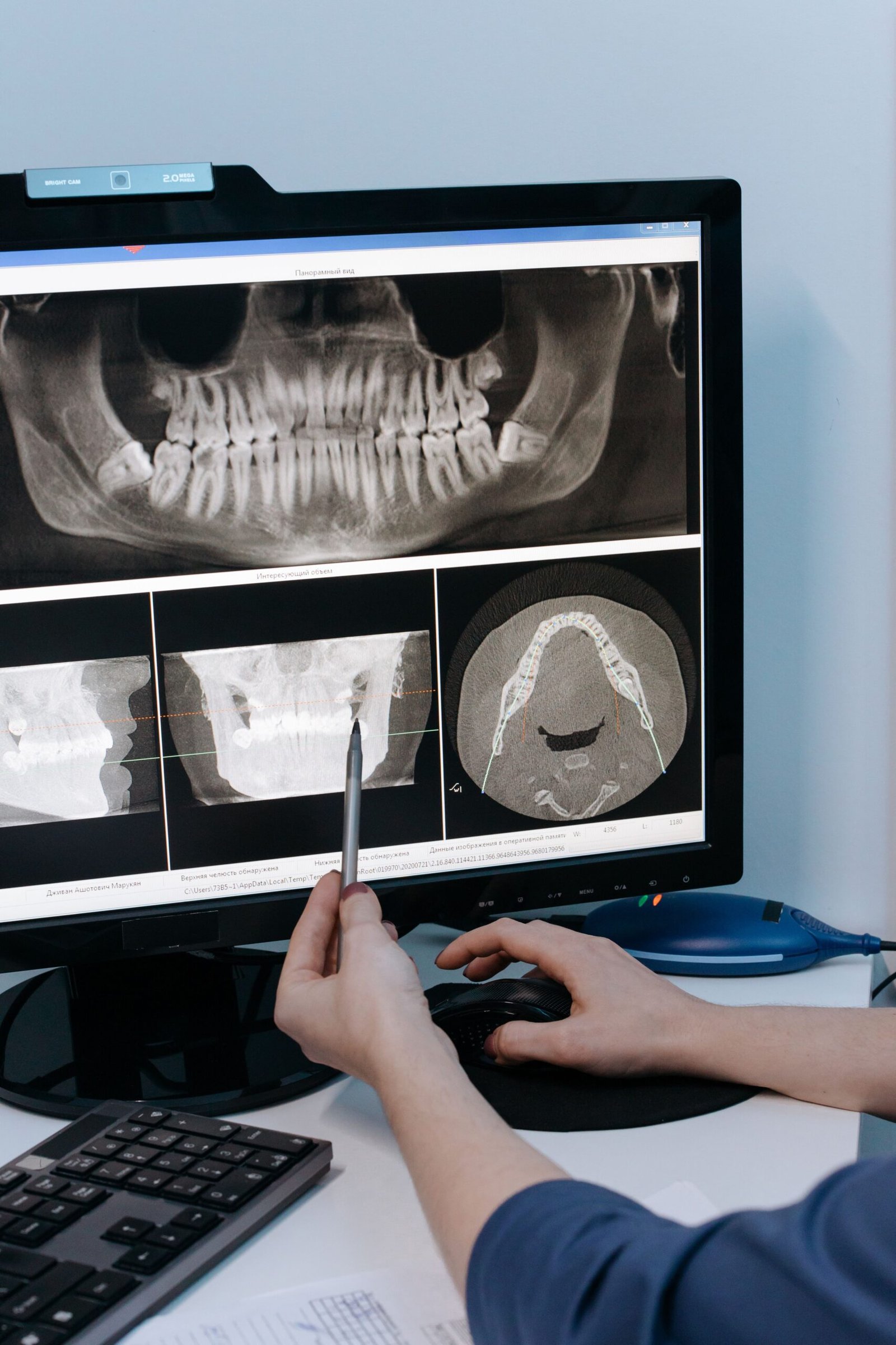 A dental professional examines dental X-ray scans displayed on a computer monitor in a clinical setting.